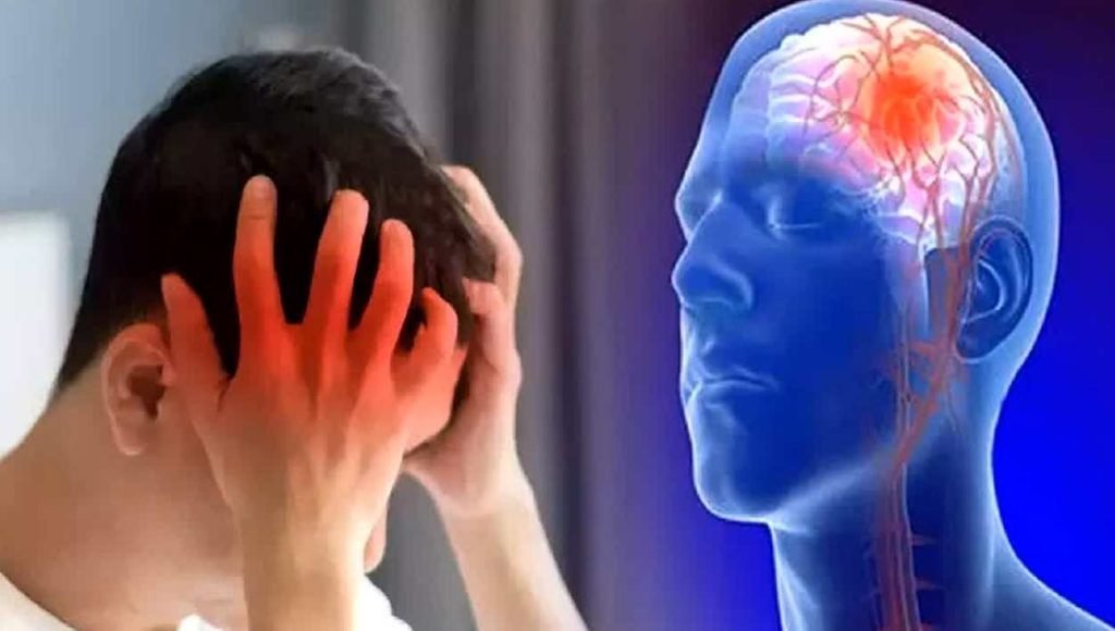 Ini Penyebab Stroke di Usia Muda