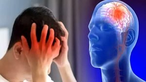 Ini Penyebab Stroke di Usia Muda